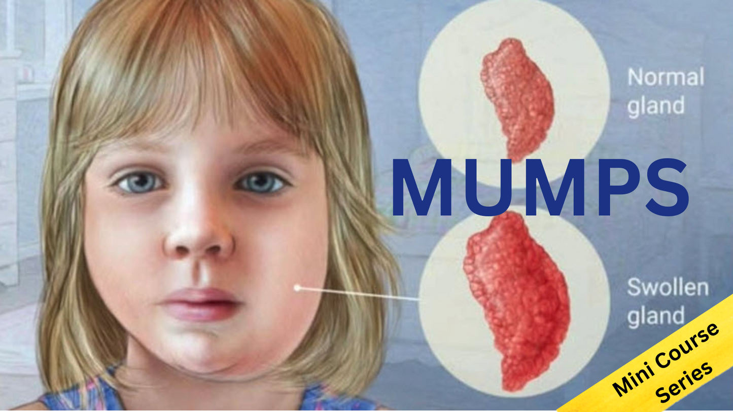 Mumps - Mini Course Series 3